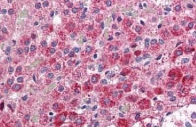 Immunohistochemistry-Paraffin: CCK-AR Antibody [NBP3-14558] - CCK-AR antibody IHC of human adrenal. Immunohistochemistry of formalin-fixed, paraffin-embedded tissue after heat-induced antigen retrieval.